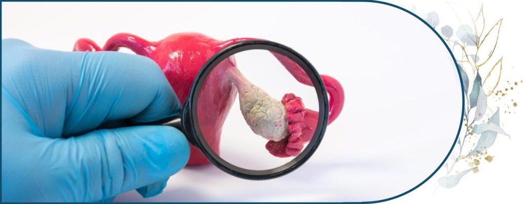 Polikistik Over (PCOS) Sorununa Doğal Yaklaşım: Hormonal Denge