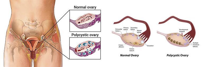 Egzersiz ve Stres Yönetimi ile Hormonal Dengenin Sağlanması