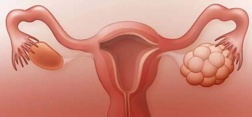 Doğal Yöntemlerle Hormonları Düzenlemenin Yolları