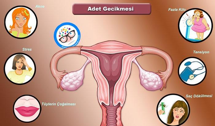Adet Düzensizliği Tedavisi: Bitkisel Çözümlerle Düzen Sağlayın