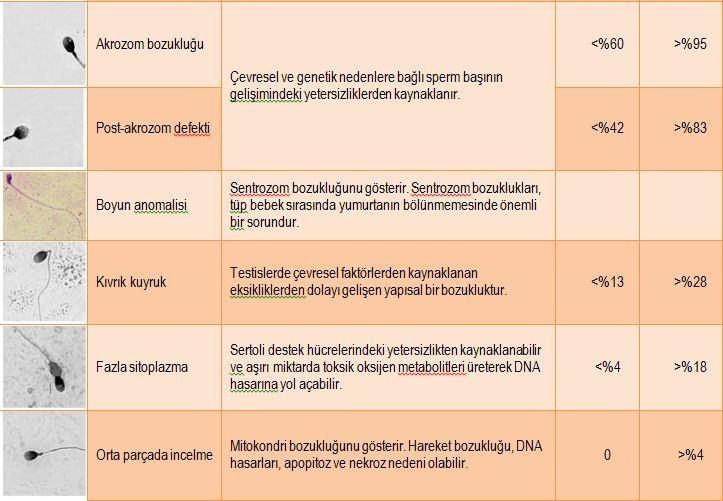 Sperm Morfolojik Bozukluk Nedenleri ve Belirtileri